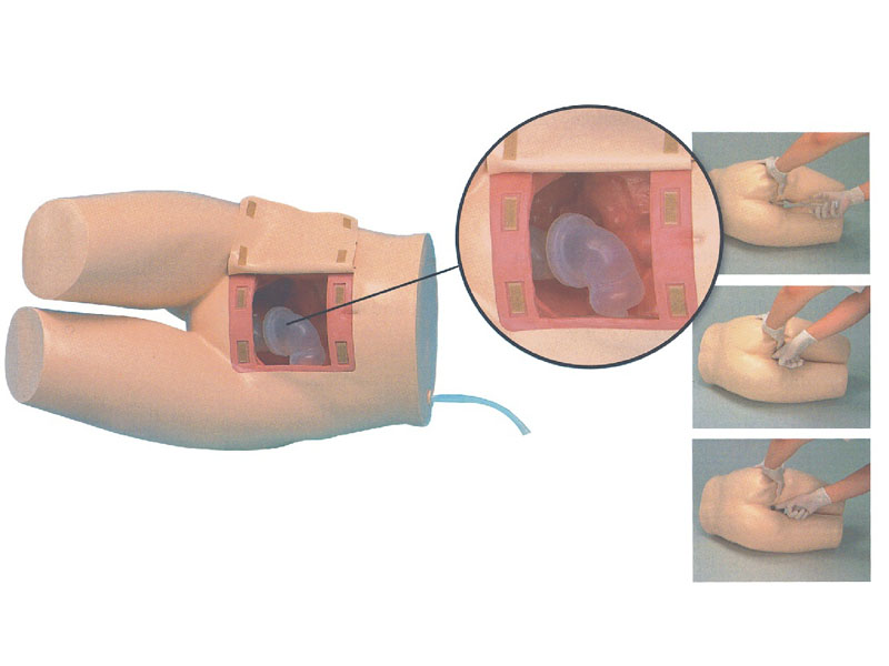 灌肠和辅助排便训练模型
